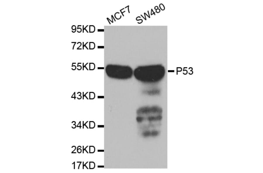 Western blot - TP53 Antibody from Signalway Antibody (32051) - Antibodies.com
