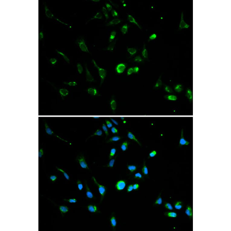 Immunofluorescence - TP53 Antibody from Signalway Antibody (32051) - Antibodies.com