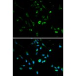 Immunofluorescence - TP53 Antibody from Signalway Antibody (32051) - Antibodies.com