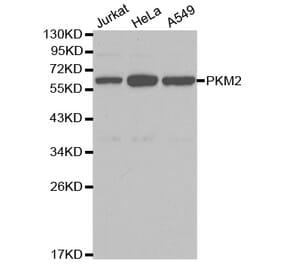 Western blot - PKM2 Antibody from Signalway Antibody (32054) - Antibodies.com