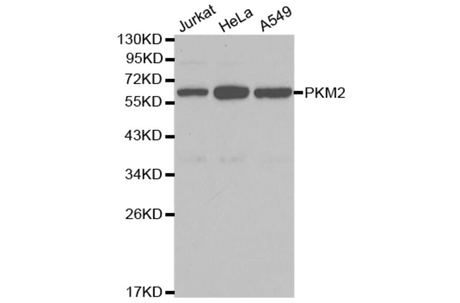Western blot - PKM2 Antibody from Signalway Antibody (32054) - Antibodies.com