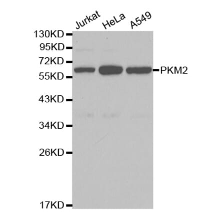 Western blot - PKM2 Antibody from Signalway Antibody (32054) - Antibodies.com