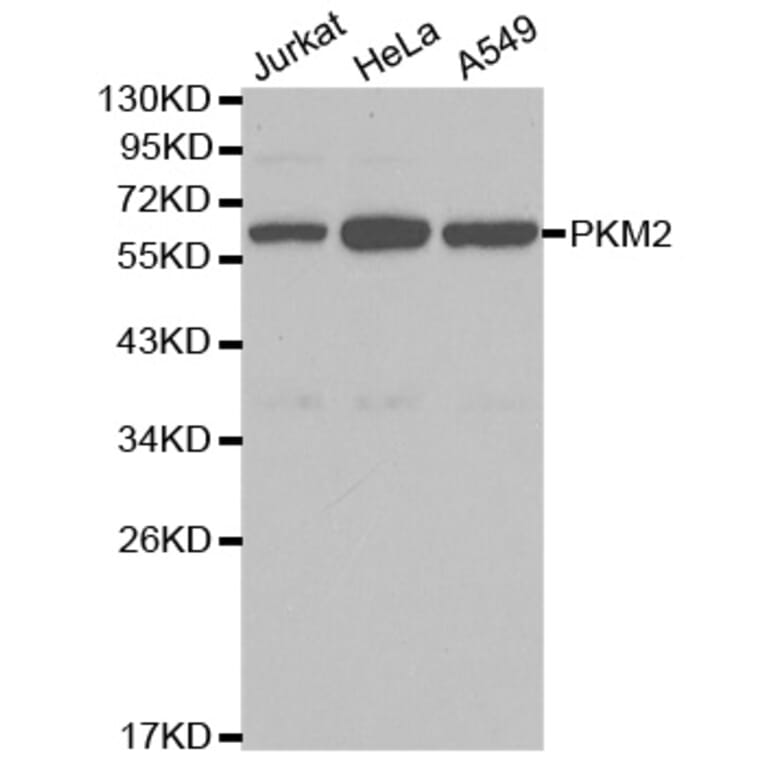 Western blot - PKM2 Antibody from Signalway Antibody (32054) - Antibodies.com