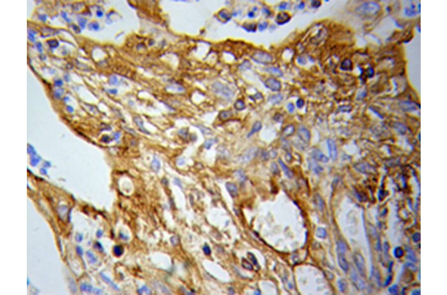 Immunohistochemistry - PKM2 Antibody from Signalway Antibody (32054) - Antibodies.com