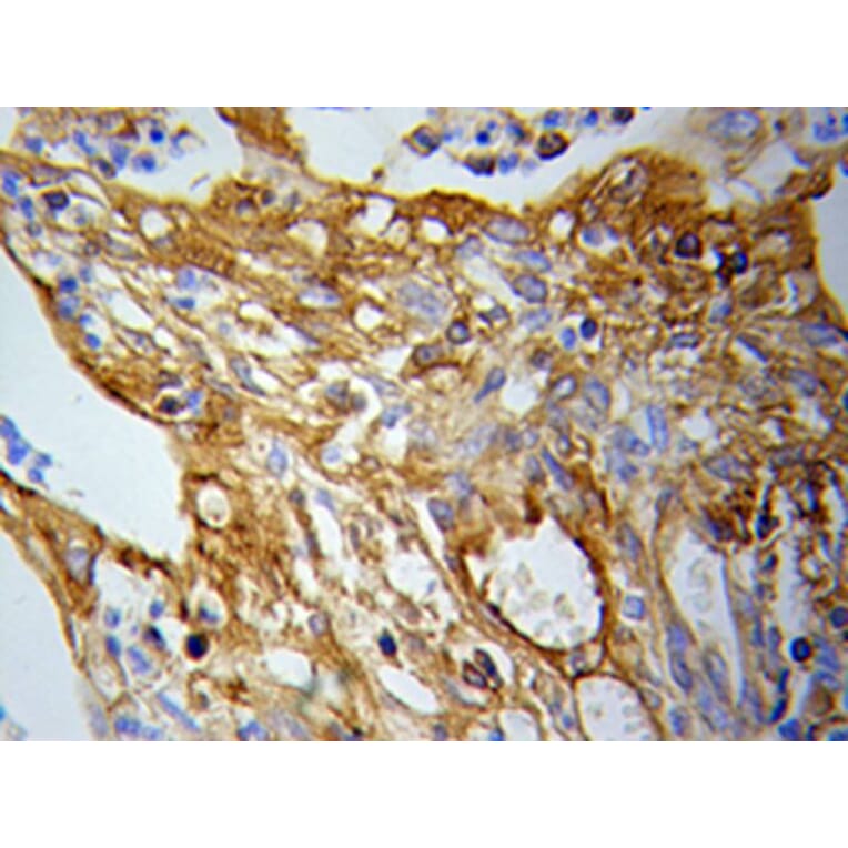 Immunohistochemistry - PKM2 Antibody from Signalway Antibody (32054) - Antibodies.com