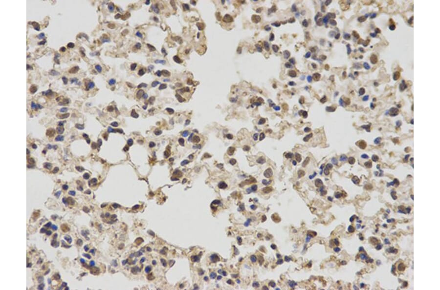 Immunohistochemistry - PKM2 Antibody from Signalway Antibody (32054) - Antibodies.com