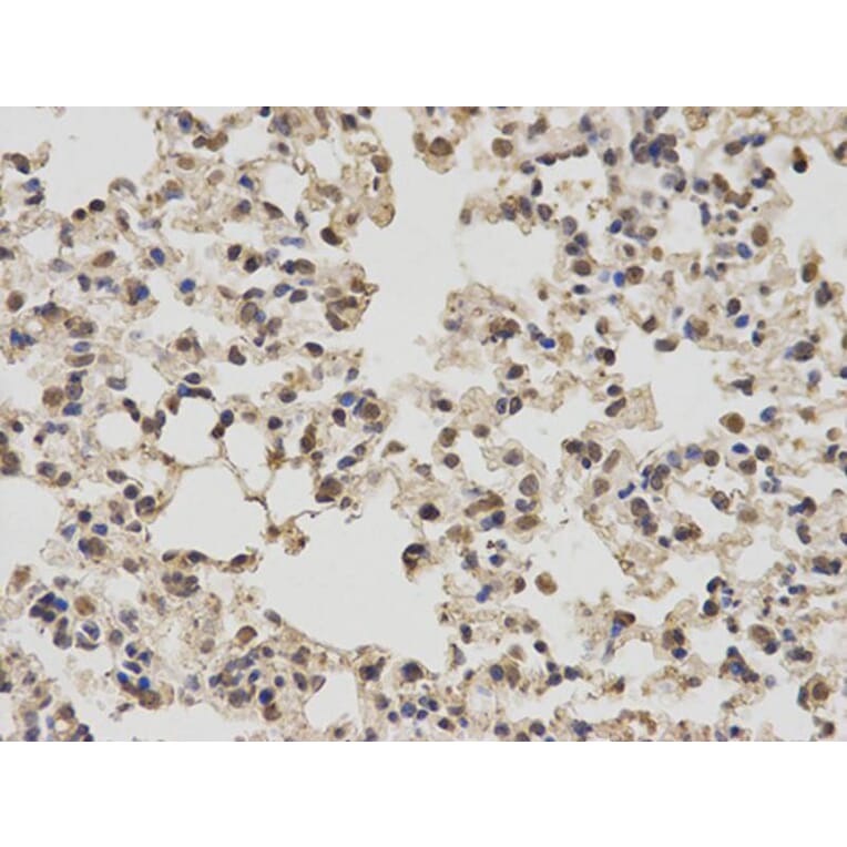 Immunohistochemistry - PKM2 Antibody from Signalway Antibody (32054) - Antibodies.com