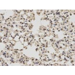 Immunohistochemistry - PKM2 Antibody from Signalway Antibody (32054) - Antibodies.com