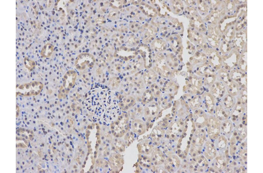 Immunohistochemistry - PKM2 Antibody from Signalway Antibody (32054) - Antibodies.com