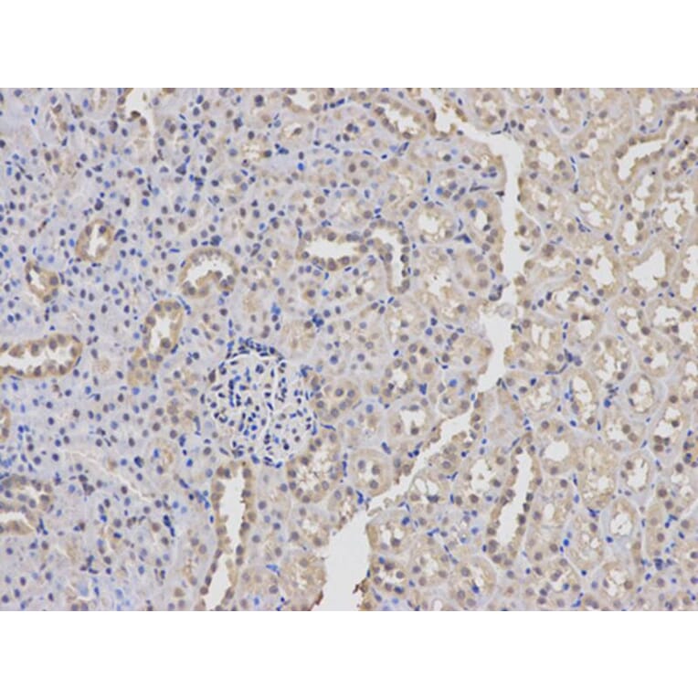 Immunohistochemistry - PKM2 Antibody from Signalway Antibody (32054) - Antibodies.com