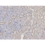 Immunohistochemistry - PKM2 Antibody from Signalway Antibody (32054) - Antibodies.com