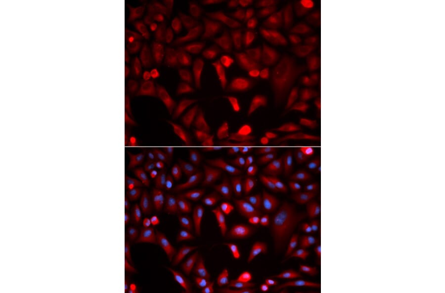 Immunofluorescence - PKM2 Antibody from Signalway Antibody (32054) - Antibodies.com