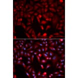 Immunofluorescence - PKM2 Antibody from Signalway Antibody (32054) - Antibodies.com