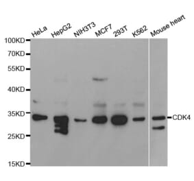 Western blot - CDK4 Antibody from Signalway Antibody (32073) - Antibodies.com