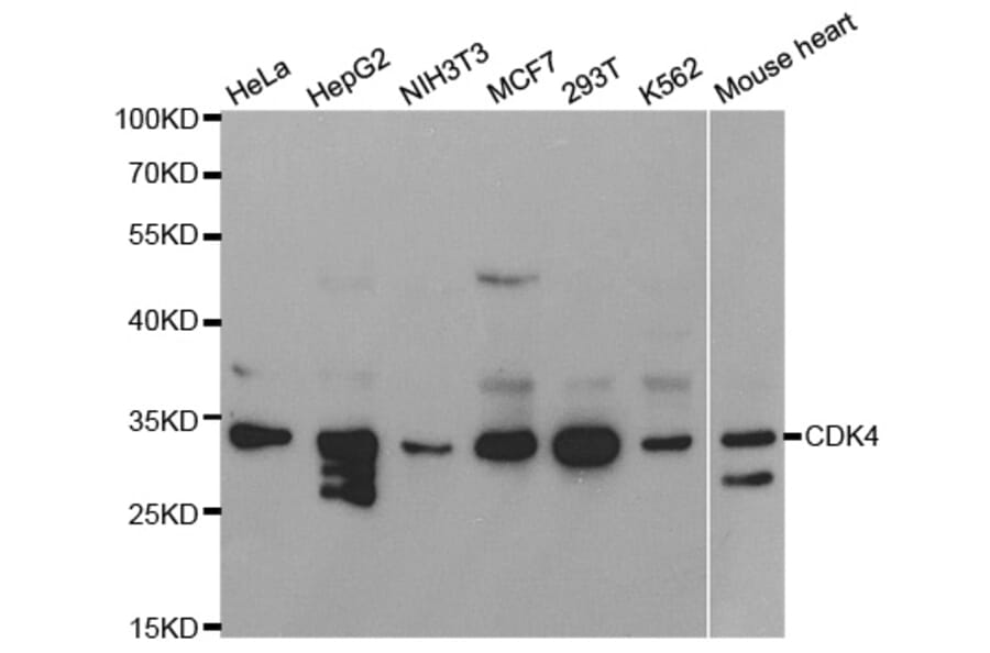 Western blot - CDK4 Antibody from Signalway Antibody (32073) - Antibodies.com