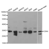 Western blot - CDK4 Antibody from Signalway Antibody (32073) - Antibodies.com