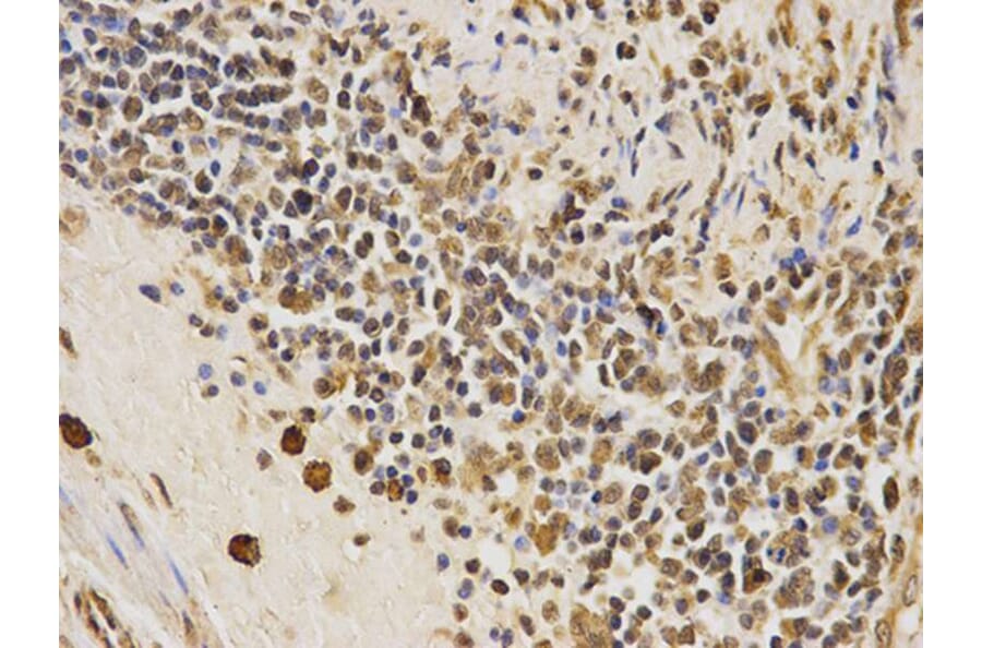 Immunohistochemistry - CDK4 Antibody from Signalway Antibody (32073) - Antibodies.com