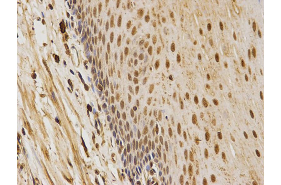 Immunohistochemistry - CDK4 Antibody from Signalway Antibody (32073) - Antibodies.com
