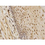 Immunohistochemistry - CDK4 Antibody from Signalway Antibody (32073) - Antibodies.com