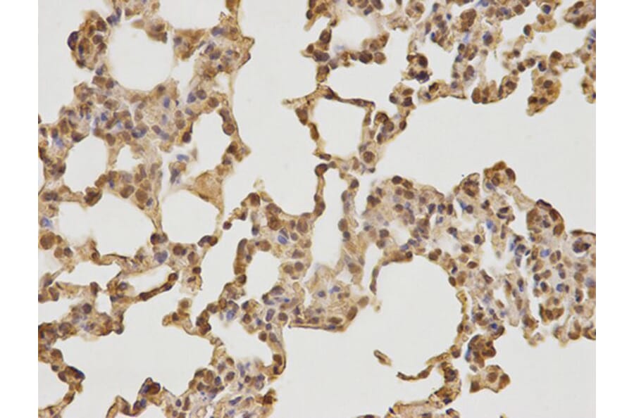 Immunohistochemistry - CDK4 Antibody from Signalway Antibody (32073) - Antibodies.com