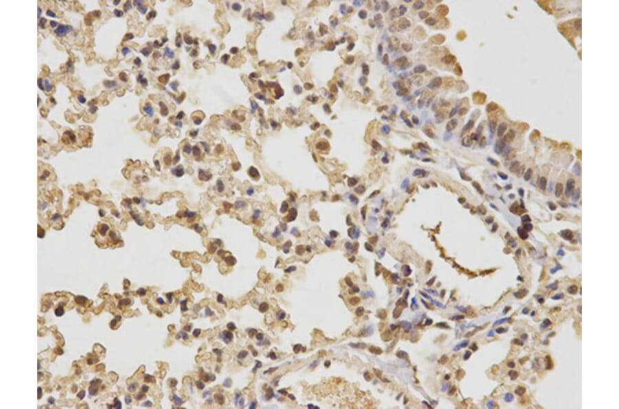 Immunohistochemistry - CDK4 Antibody from Signalway Antibody (32073) - Antibodies.com