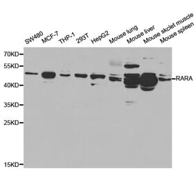 Western blot - RARA Antibody from Signalway Antibody (32074) - Antibodies.com