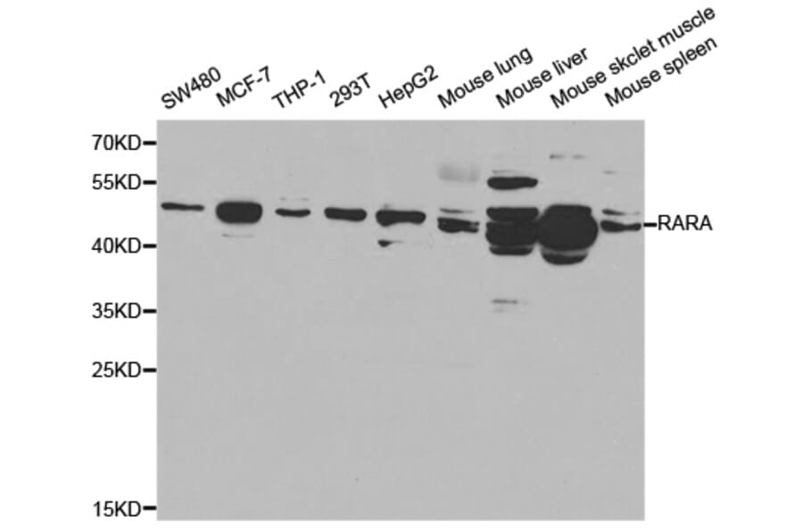 Western blot - RARA Antibody from Signalway Antibody (32074) - Antibodies.com