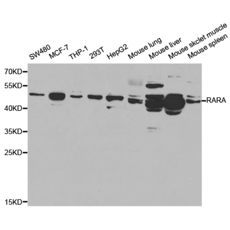 Western blot - RARA Antibody from Signalway Antibody (32074) - Antibodies.com