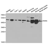 Western blot - RARA Antibody from Signalway Antibody (32074) - Antibodies.com