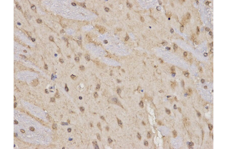 Immunohistochemistry - RARA Antibody from Signalway Antibody (32074) - Antibodies.com