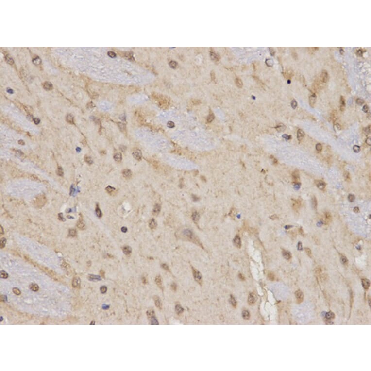 Immunohistochemistry - RARA Antibody from Signalway Antibody (32074) - Antibodies.com