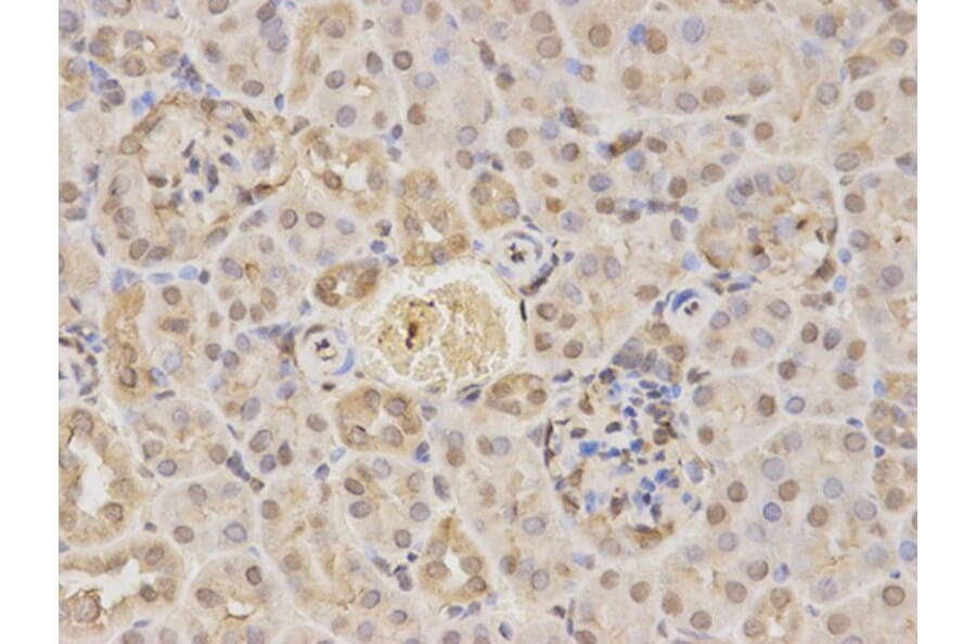 Immunohistochemistry - RARA Antibody from Signalway Antibody (32074) - Antibodies.com