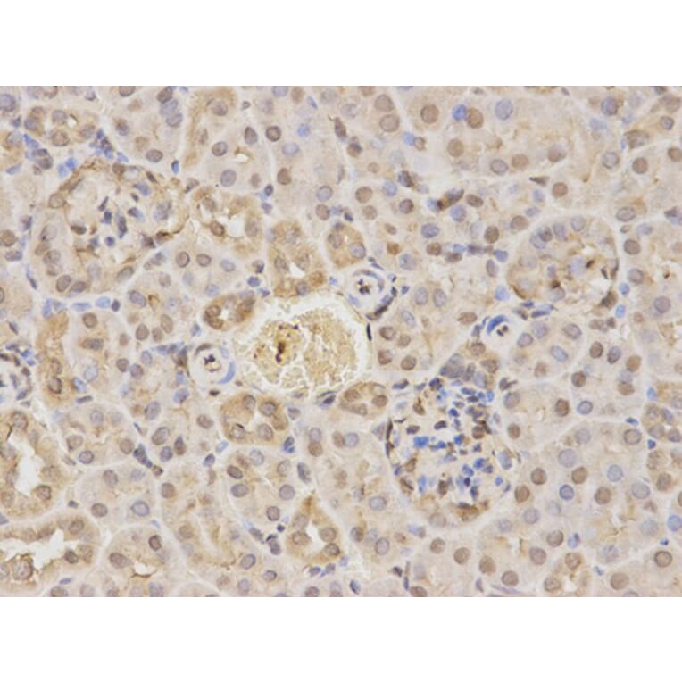 Immunohistochemistry - RARA Antibody from Signalway Antibody (32074) - Antibodies.com