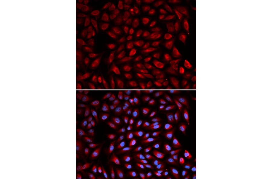 Immunofluorescence - RARA Antibody from Signalway Antibody (32074) - Antibodies.com