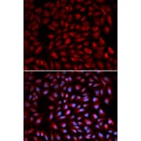 Immunofluorescence - RARA Antibody from Signalway Antibody (32074) - Antibodies.com