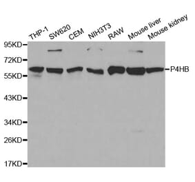 Western blot - P4HB Antibody from Signalway Antibody (32085) - Antibodies.com