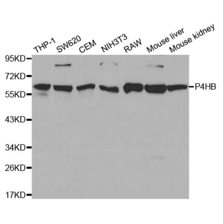 Western blot - P4HB Antibody from Signalway Antibody (32085) - Antibodies.com