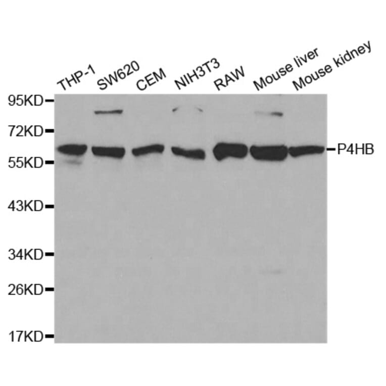 Western blot - P4HB Antibody from Signalway Antibody (32085) - Antibodies.com