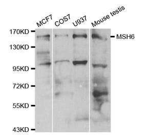 Western blot - MSH6 Antibody from Signalway Antibody (32108) - Antibodies.com