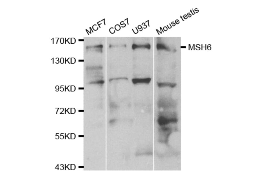 Western blot - MSH6 Antibody from Signalway Antibody (32108) - Antibodies.com