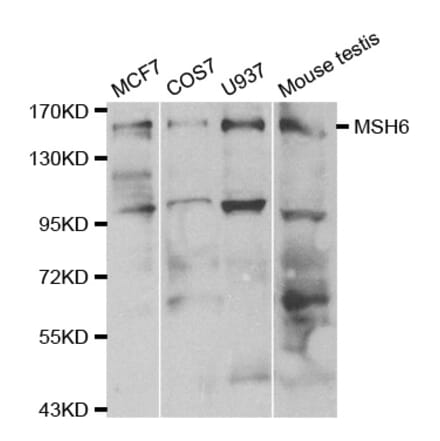 Western blot - MSH6 Antibody from Signalway Antibody (32108) - Antibodies.com