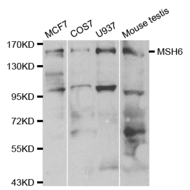 Western blot - MSH6 Antibody from Signalway Antibody (32108) - Antibodies.com