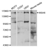 Western blot - MSH6 Antibody from Signalway Antibody (32108) - Antibodies.com