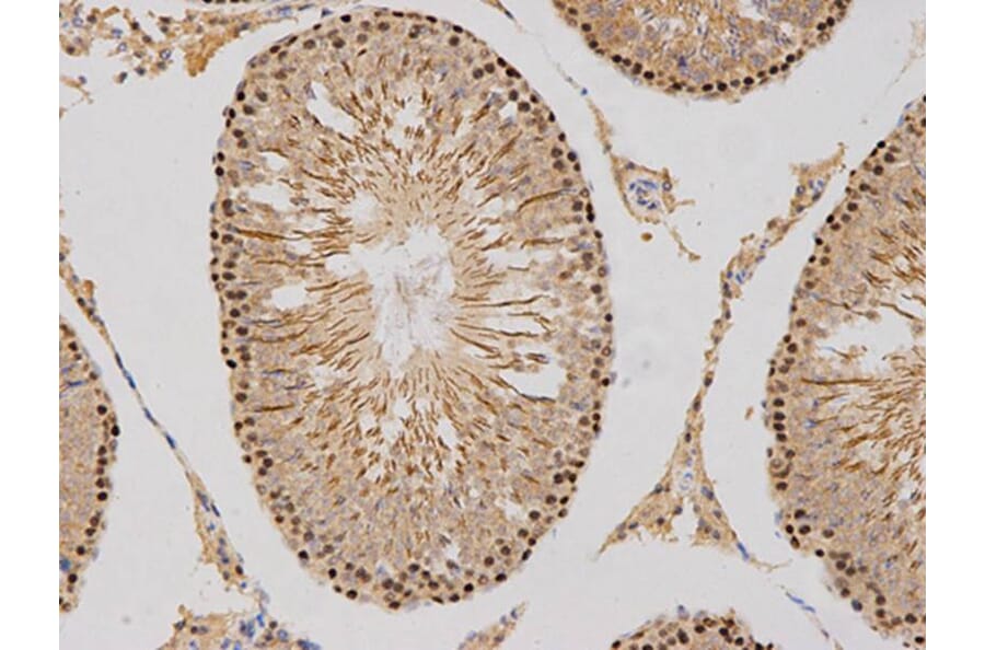Immunohistochemistry - MSH6 Antibody from Signalway Antibody (32108) - Antibodies.com