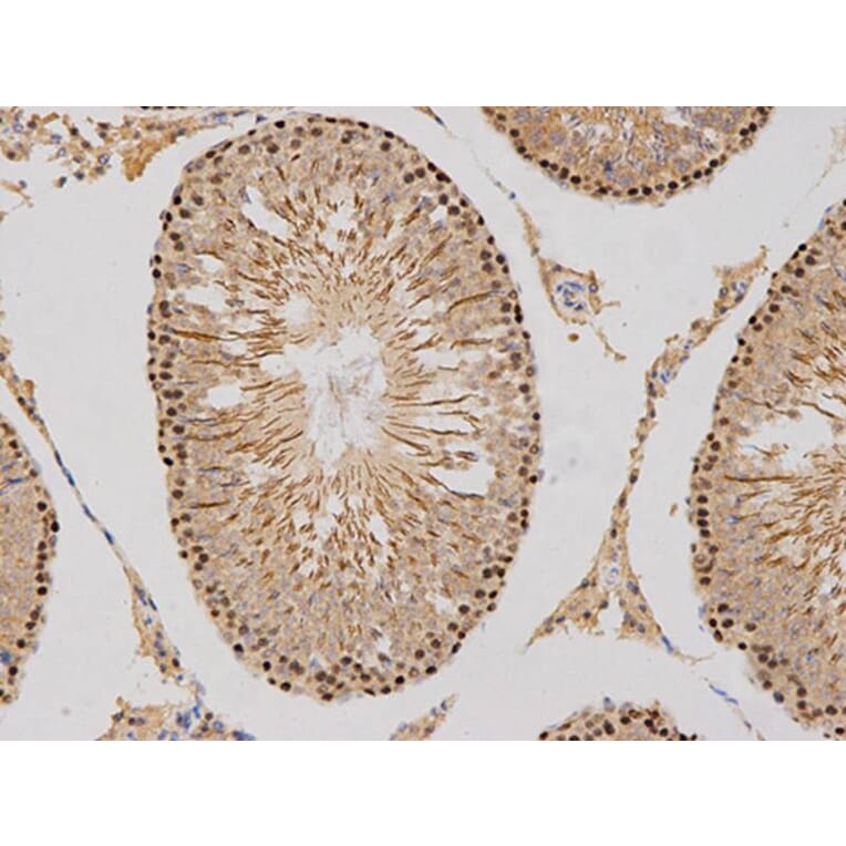 Immunohistochemistry - MSH6 Antibody from Signalway Antibody (32108) - Antibodies.com