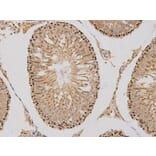 Immunohistochemistry - MSH6 Antibody from Signalway Antibody (32108) - Antibodies.com