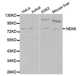 Western blot - NEK8 Antibody from Signalway Antibody (32109) - Antibodies.com