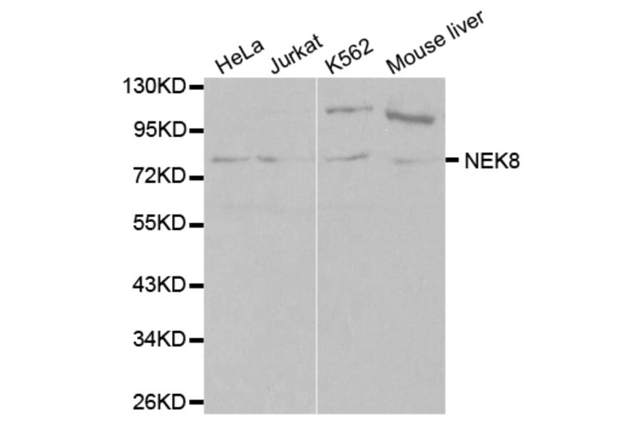 Western blot - NEK8 Antibody from Signalway Antibody (32109) - Antibodies.com