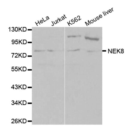 Western blot - NEK8 Antibody from Signalway Antibody (32109) - Antibodies.com