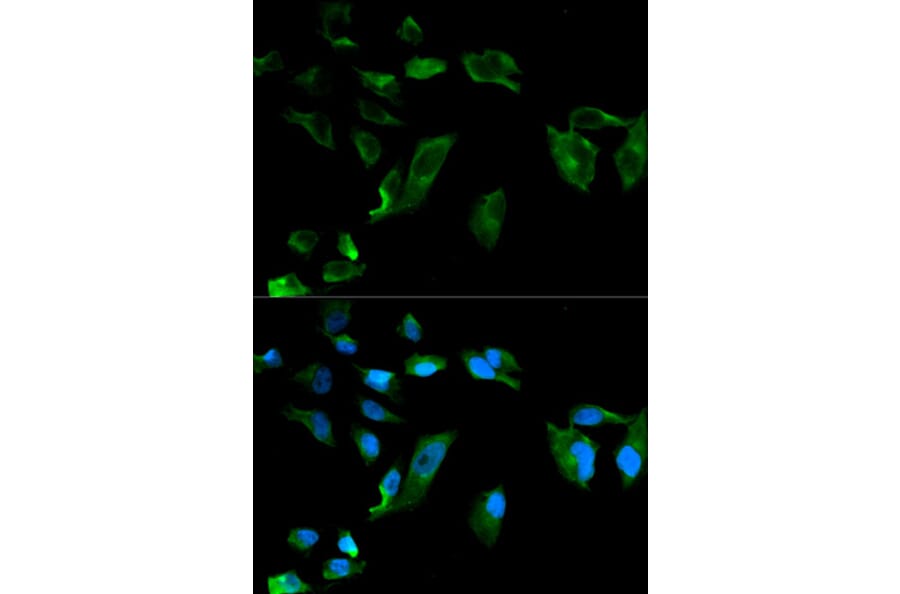 Immunofluorescence - NEK8 Antibody from Signalway Antibody (32109) - Antibodies.com